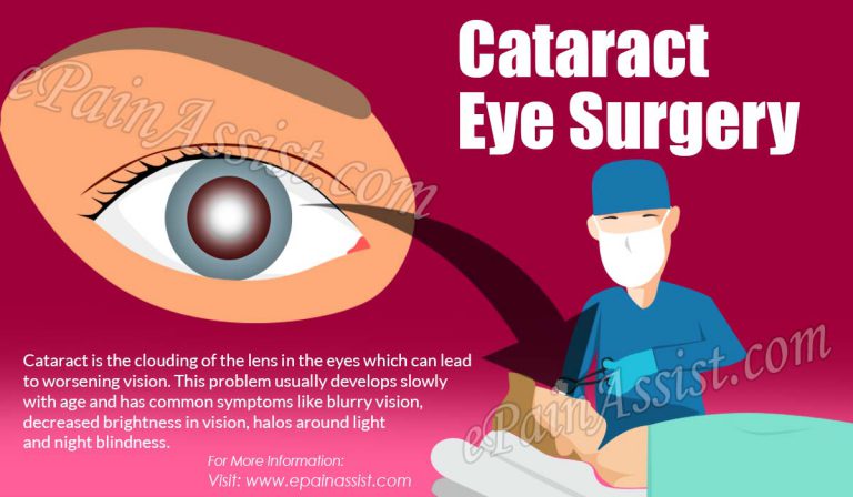 Cataract Eye Surgery: What To Expect, Dos & Don’ts, Dry Eye Syndrome