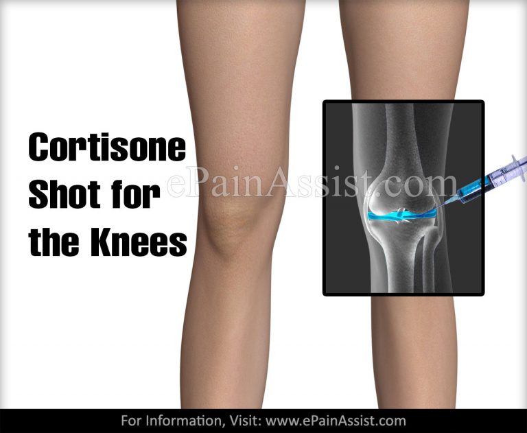Cortisone Shots for Joint Pain: Knee, Hip, Ankle, Spine, Wrist