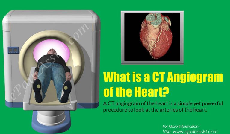 What is a CT Angiogram of the Heart?