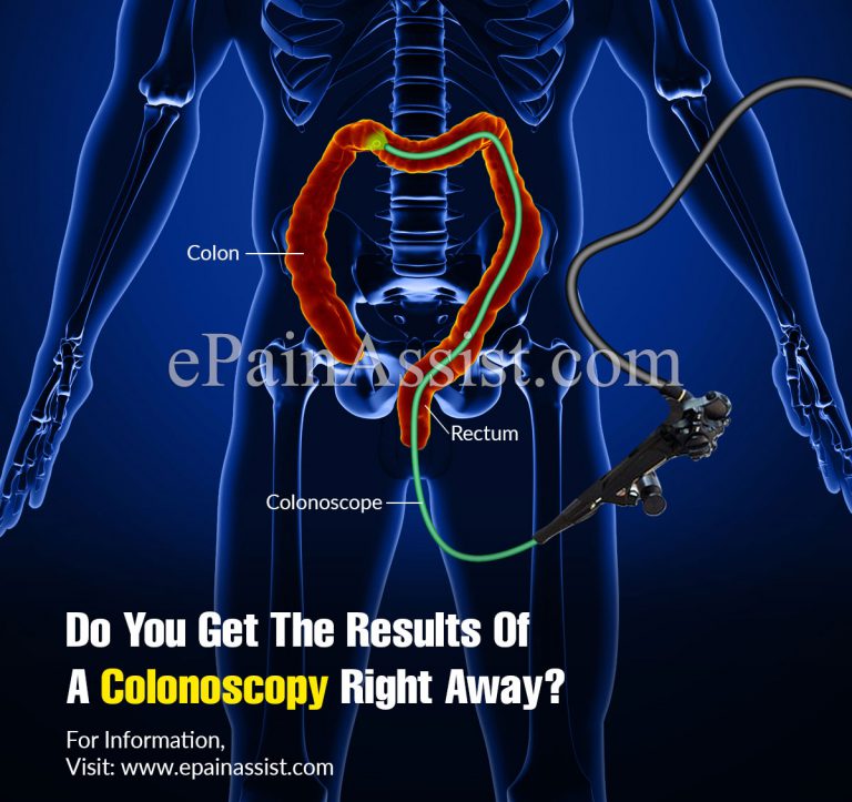 Do You Get The Results Of A Colonoscopy Right Away?