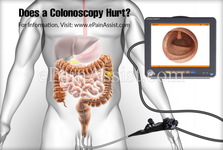 Does a Colonoscopy Hurt?