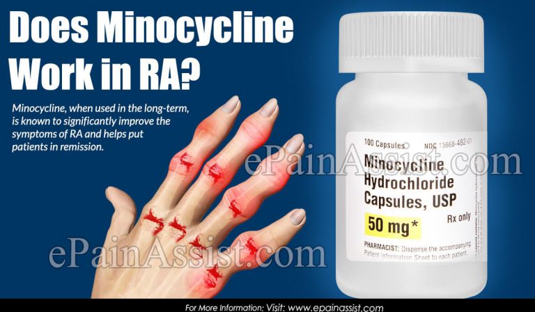 Does Minocycline Work in Treating RA & What are its Side Effects?