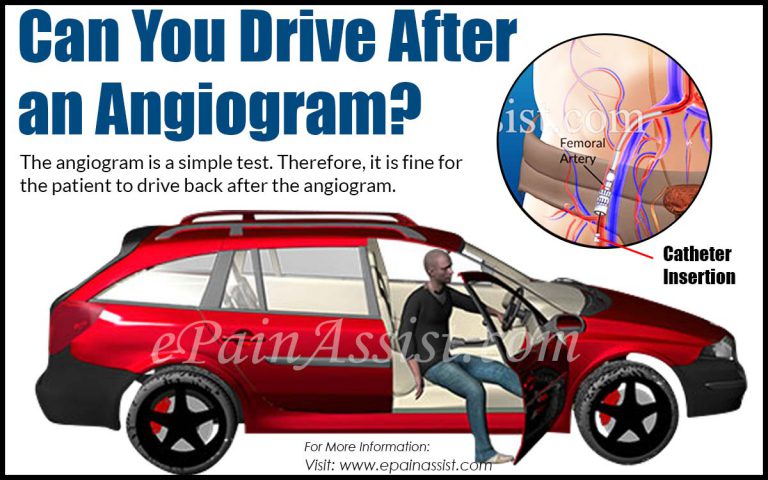 Can You Drive After an Angiogram?