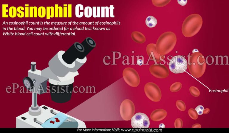 Eosinophil Count : What Does It Mean When You Have A High Or Low Eosinophil Count?