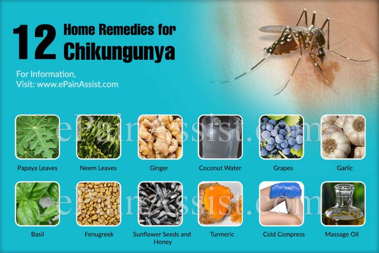 12 Simple Home Remedies for Chikungunya