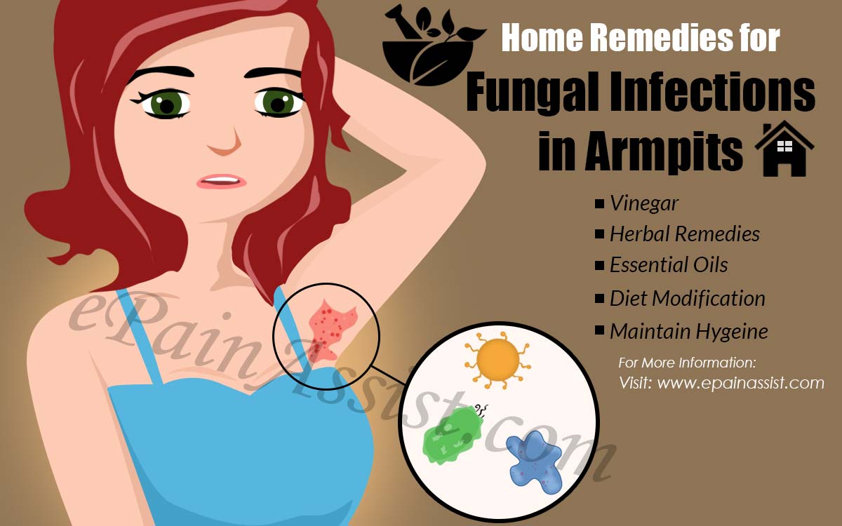 Home Remedies for Fungal Infections in Armpits