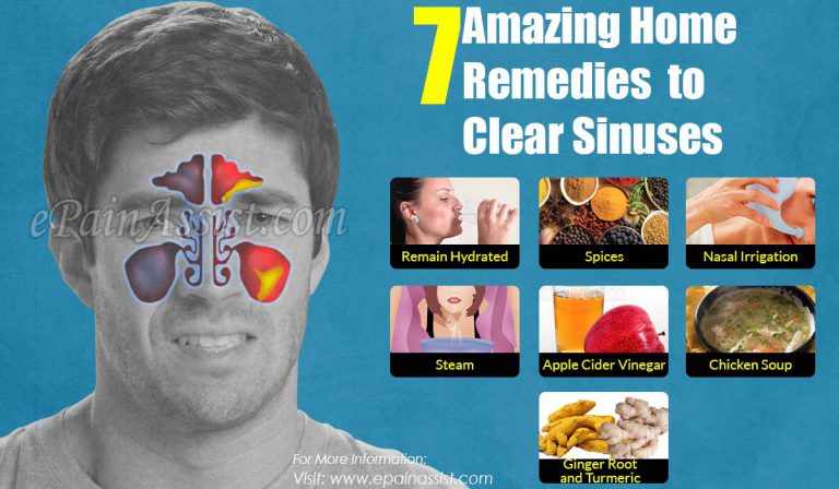 7 Amazing Home Remedies to Clear Sinuses