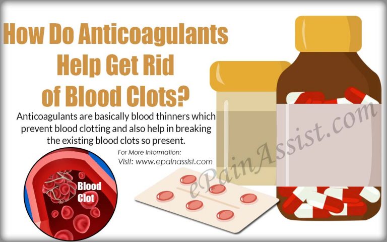 How Do Anticoagulants & Compression Stockings Help Get Rid of Blood Clot?