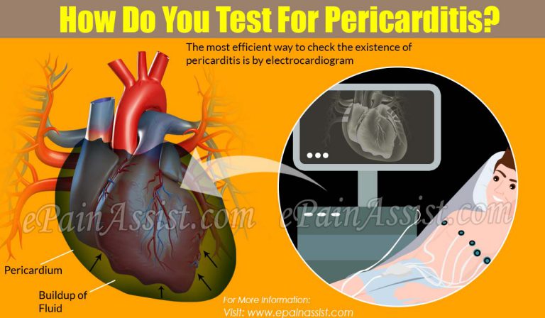 How Do You Test For Pericarditis?