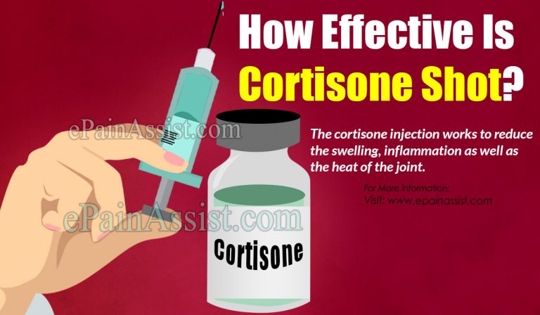 How Effective Is Cortisone Shot?