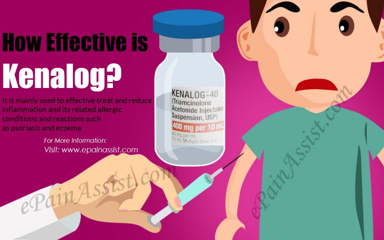 How Effective is Kenalog & What are It’s Side Effects?