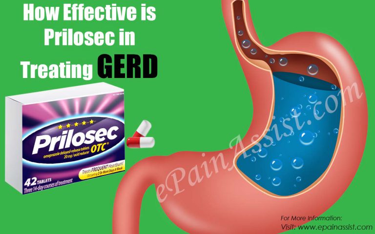 How Effective is Prilosec for GERD & What are its Side Effects, Dosage ?