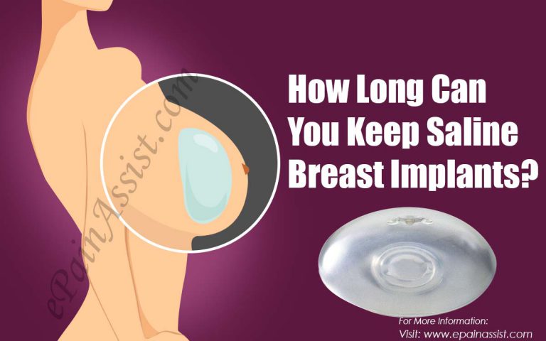 How Long Can You Keep Saline Breast Implants?