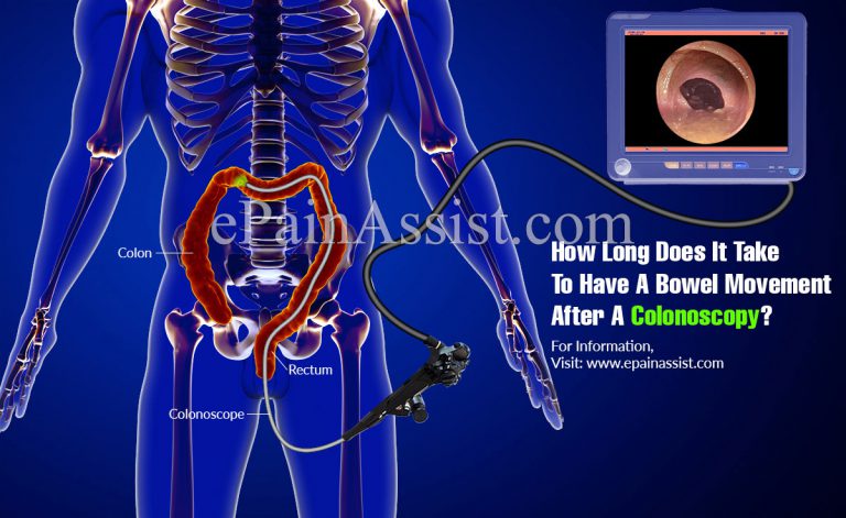 How Long Does It Take To Have A Bowel Movement After A Colonoscopy?