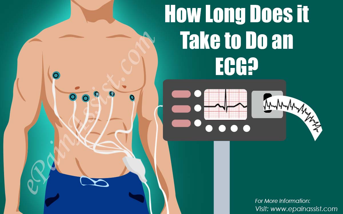 How Long Does it Take to Do an ECG?