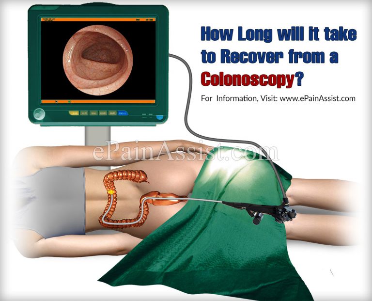 How Long will it take to Recover from a Colonoscopy?