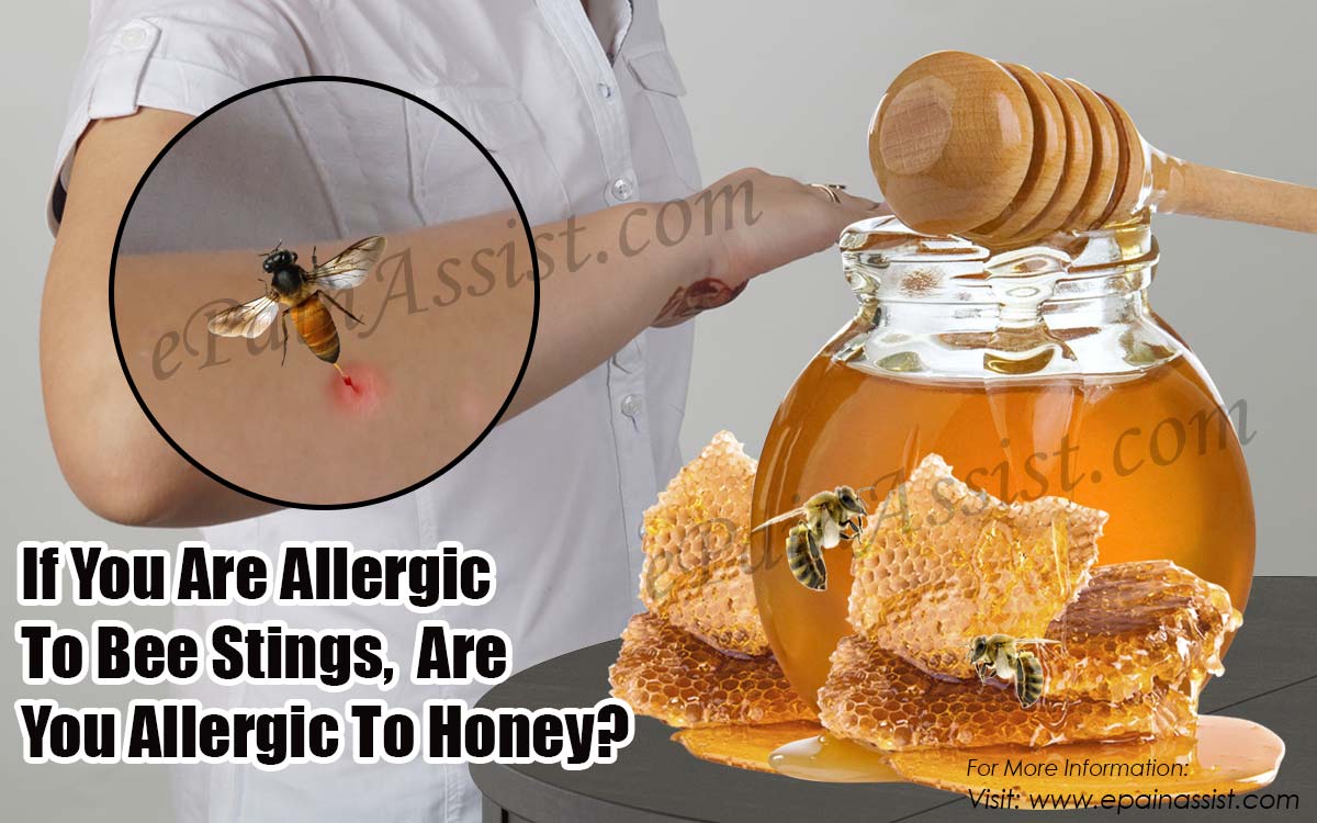 If You Are Allergic To Bee Stings, Are You Allergic To Honey?