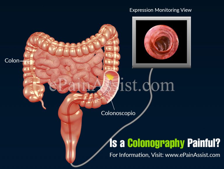 Is a Colonography Painful?