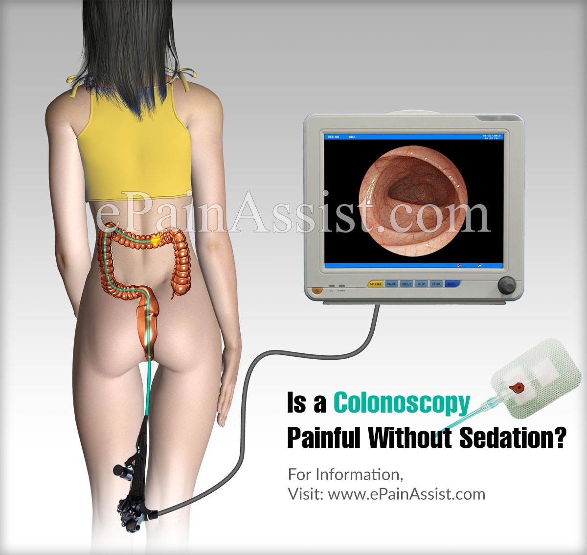 Is a Colonoscopy Painful Without Sedation?