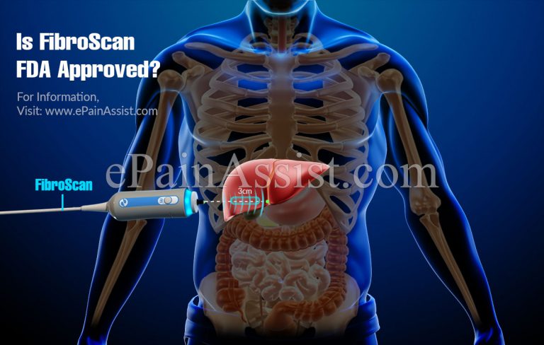 Is FibroScan FDA Approved?