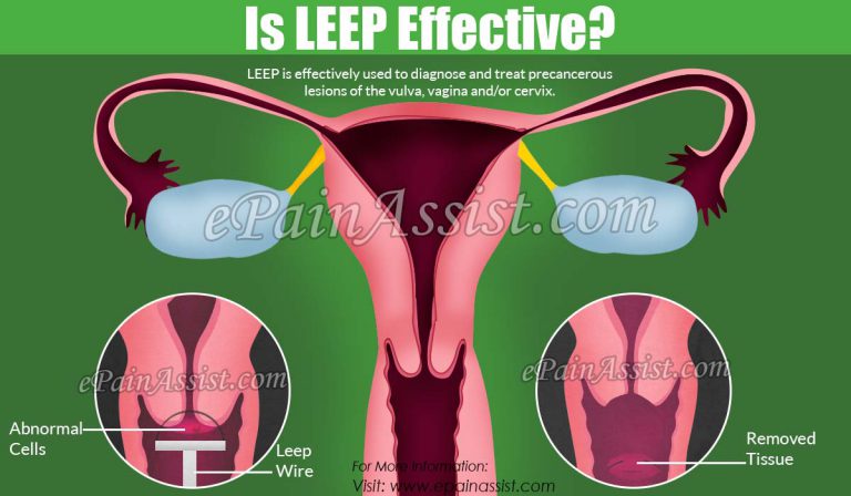 Is LEEP Effective?