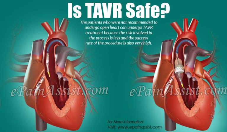 Is TAVR Safe?