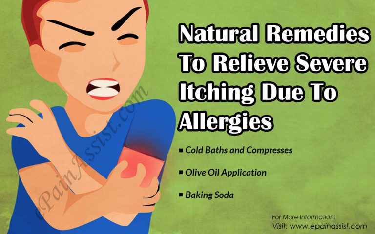 Natural Remedies To Relieve Severe Itching Due To Allergies