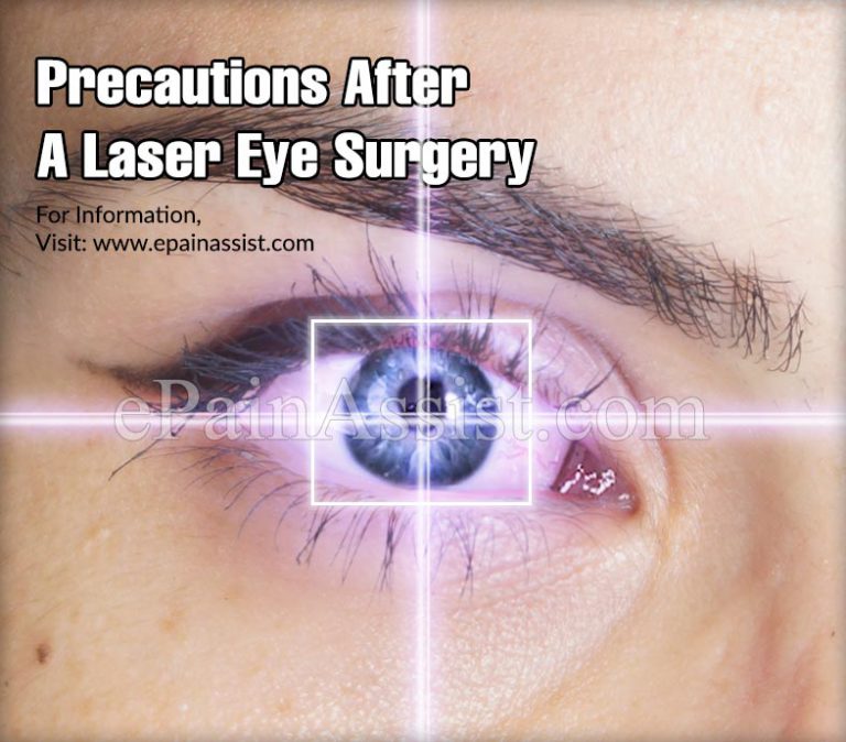 Precautions After A Laser Eye Surgery