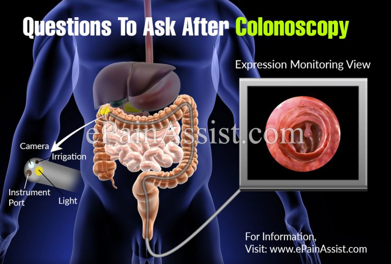 Questions To Ask After Colonoscopy