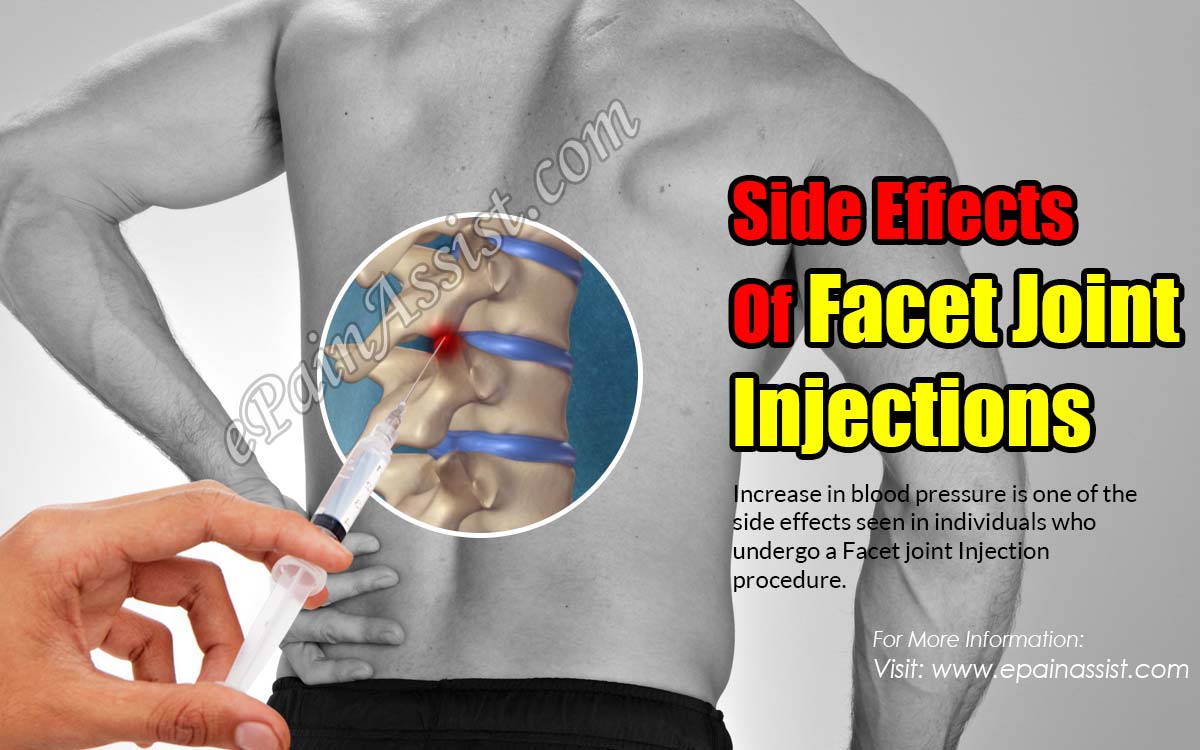 Side Effects Of Facet Joint Injections