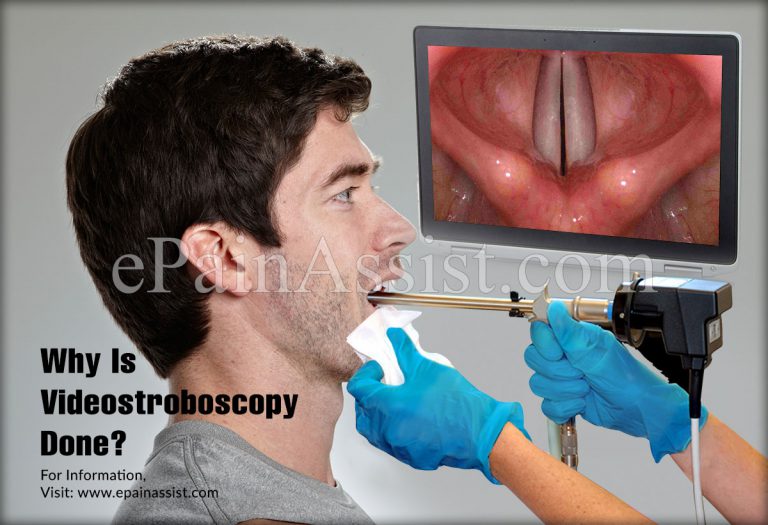 Videostroboscopy, Why is it Done and How is it Done?