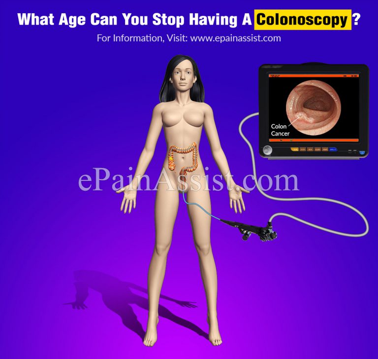 What Age Can You Stop Having A Colonoscopy?