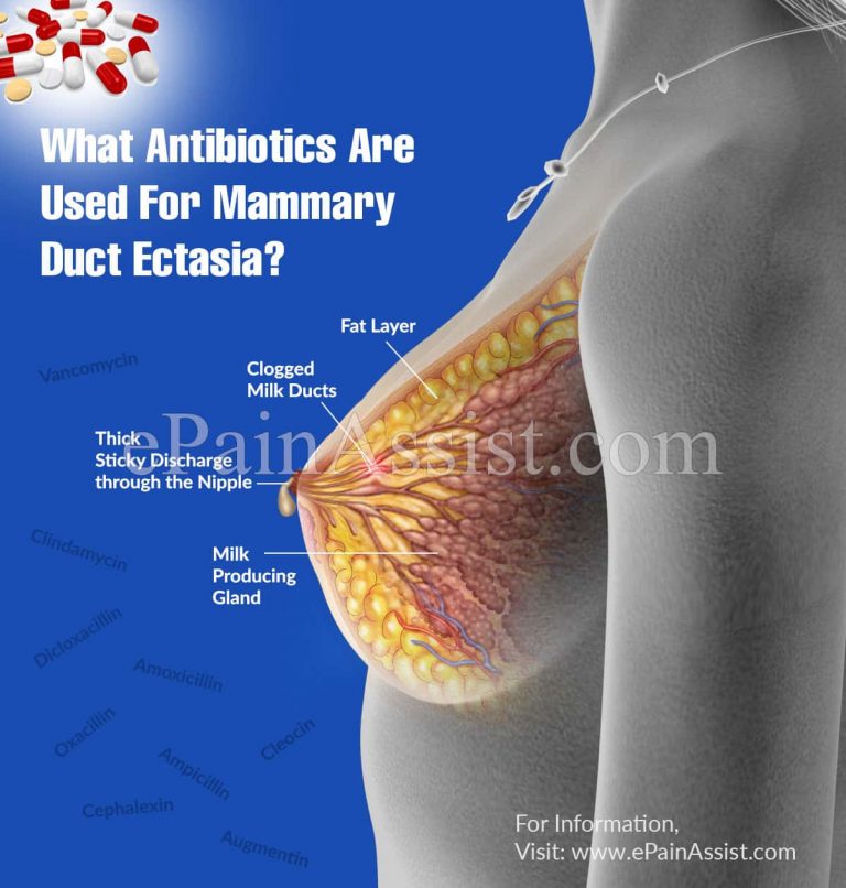 What Antibiotics Are Used For Mammary Duct Ectasia?