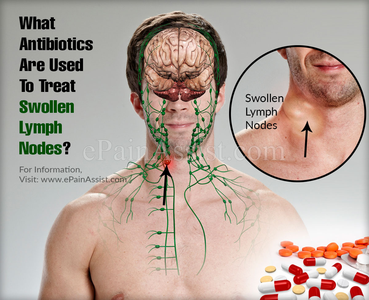 Lymph remedies nodes swollen for Are Swollen