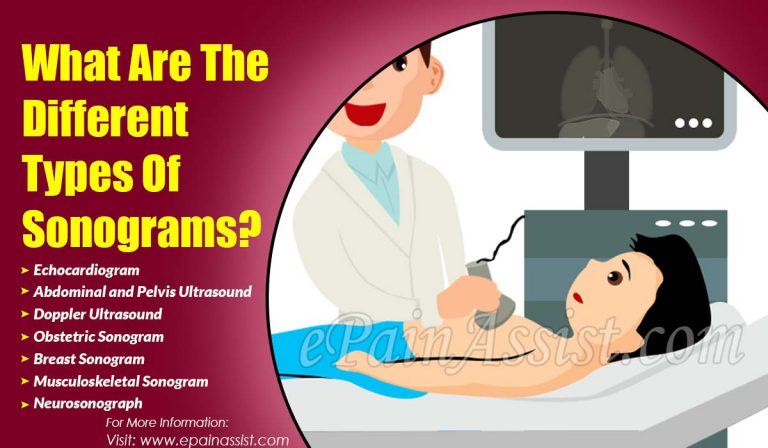 What Are The Different Types Of Sonograms?