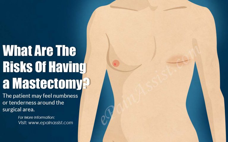 What Are The Risks Of Having A Mastectomy?
