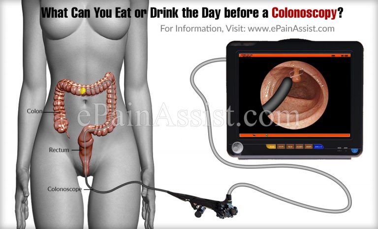 What Can You Eat or Drink the Day before a Colonoscopy?