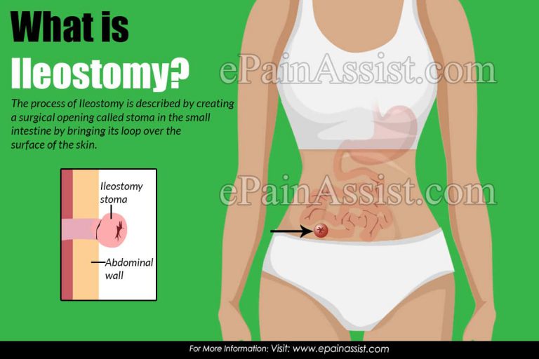What is Ileostomy and Colostomy, Why & How is it Done?