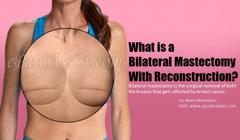 What is a Bilateral Mastectomy With Reconstruction?