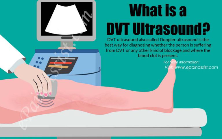 What is a DVT Ultrasound?