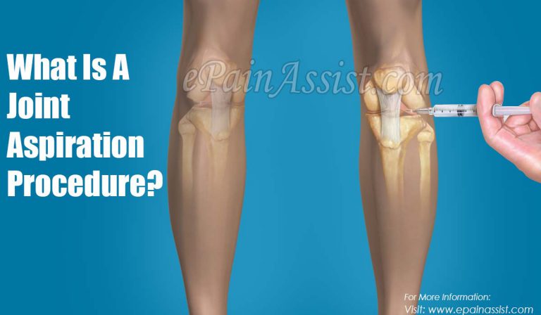 What is a Joint Aspiration Procedure, Why is it Done, How is it Done?