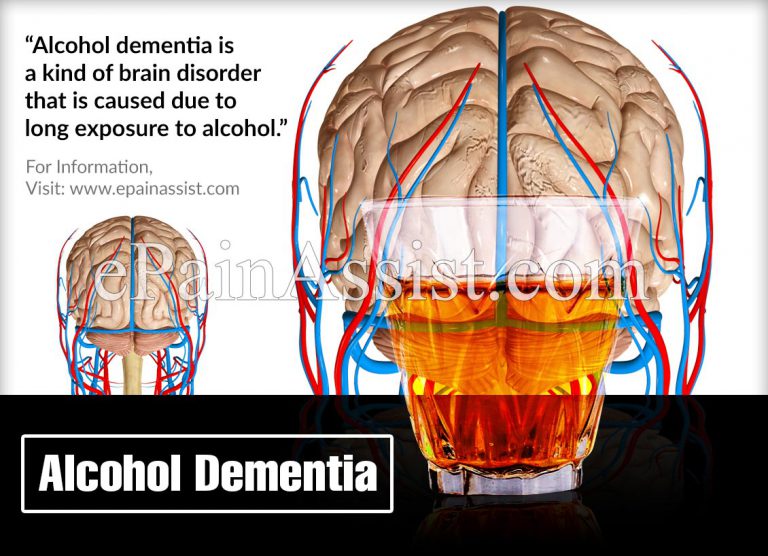 What is Alcohol Dementia: Causes, Symptoms, Stages, Treatment, Complications