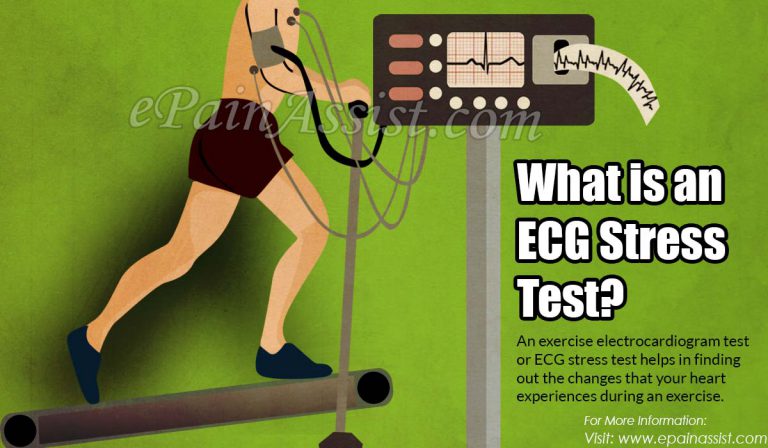 What is an ECG Stress Test?