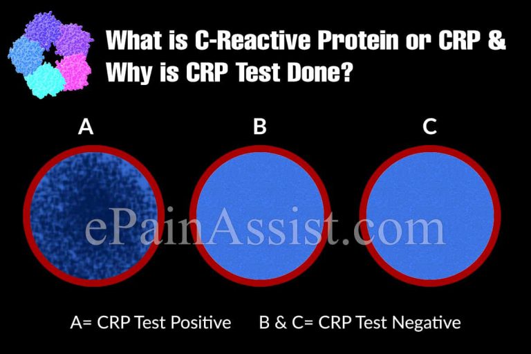 Normal Range of C-Reactive Protein, Symptoms of Elevated CRP & Its Treatment
