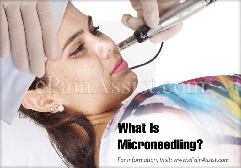 What is Microneedling, Know its Benefits & Side Effects