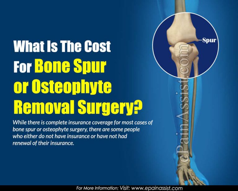 What Is The Cost For Bone Spur or Osteophyte Removal Surgery?