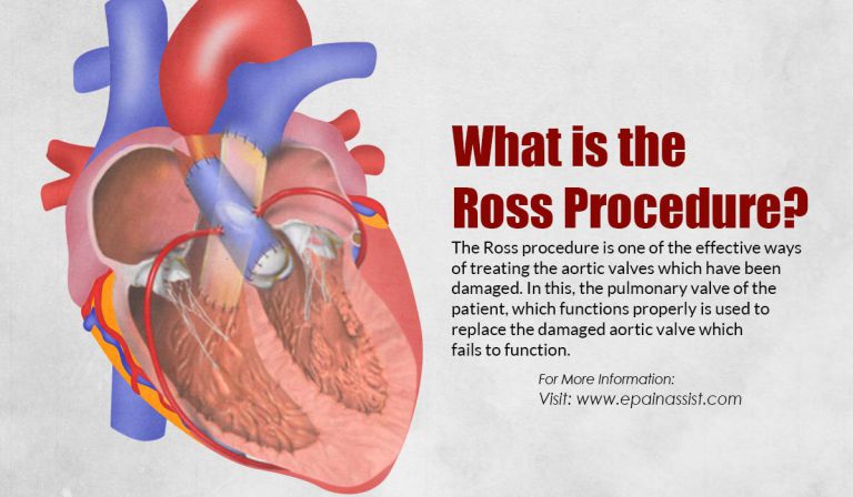What is the Ross Procedure?