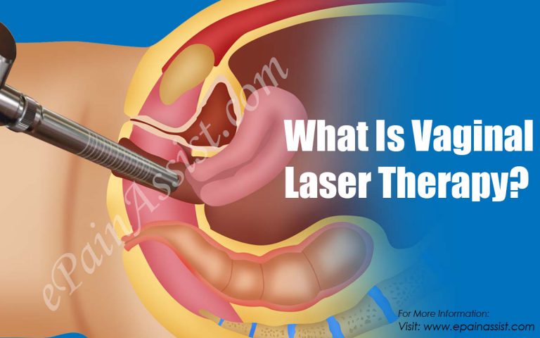 What Is Vaginal Laser Therapy & Why Is It Done?
