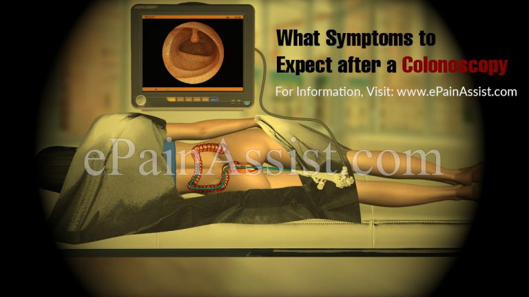 What Symptoms to Expect after a Colonoscopy?