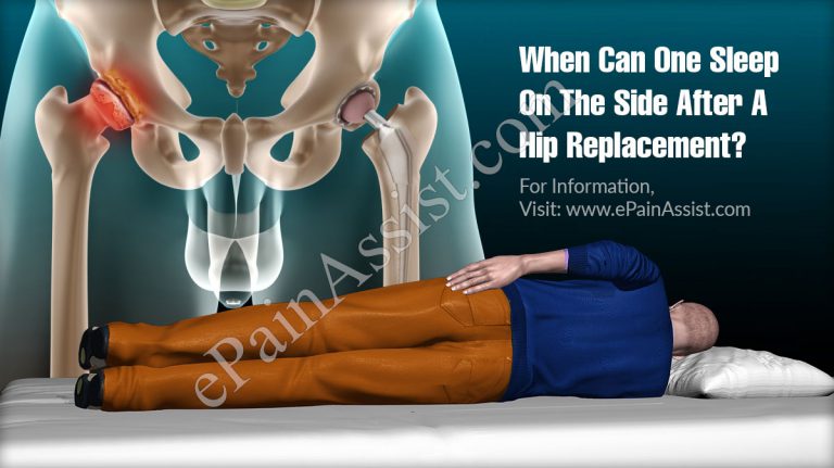 When Can One Sleep On The Side After A Hip Replacement?